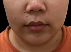 Before CoolSwiss Prime Plus